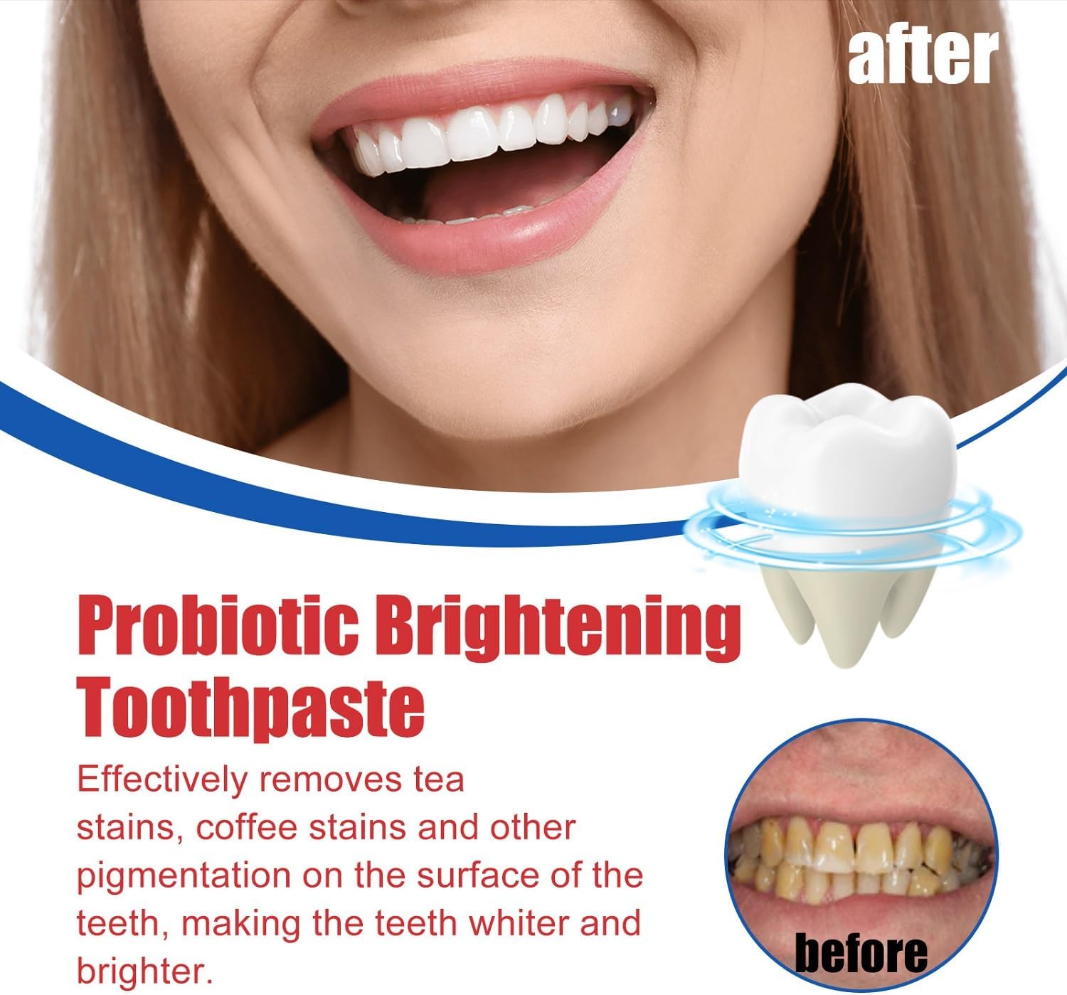 SP-6 Ultra Whitening Toothpaste – 120g (Free Home Delivery)