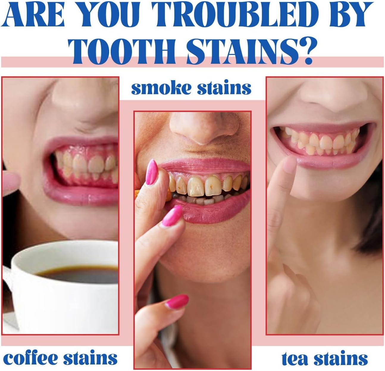 SP-6 Ultra Whitening Toothpaste – 120g (Free Home Delivery)