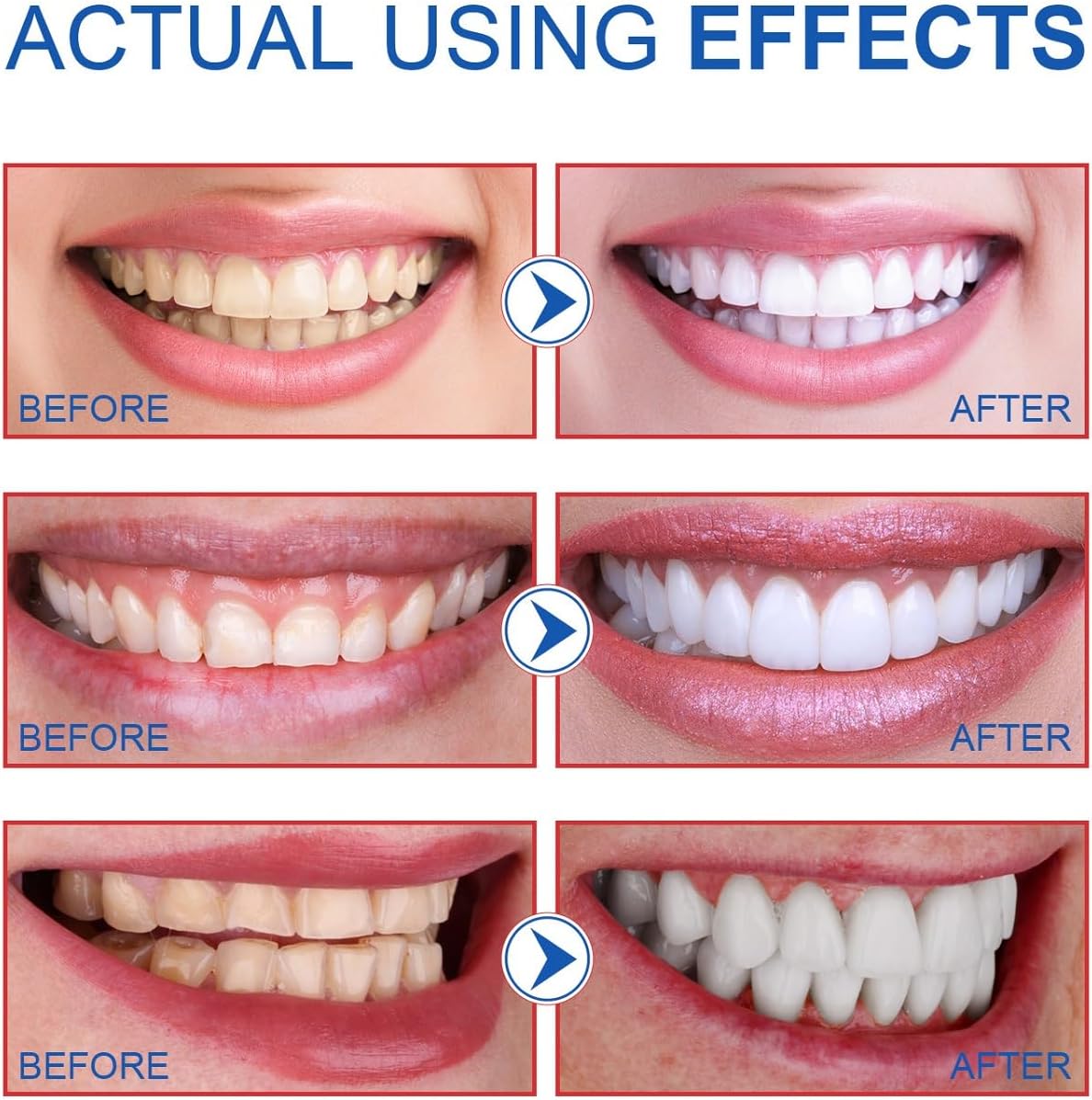 SP-6 Ultra Whitening Toothpaste – 120g (Free Home Delivery)